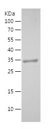    PSAP / Recombinant Human PSAP