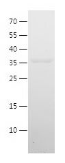    RNASEH2C / Recombinant Human RNASEH2C