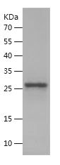    RPGR / Recombinant Human RPGR