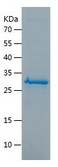    KI67 / Recombinant Human KI67