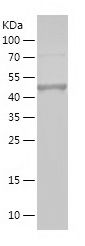    RIOK1 / Recombinant Human RIOK1