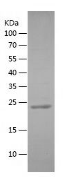    ARMCX3 / Recombinant Human ARMCX3