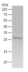    CA3 / Recombinant Human CA3