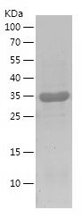    BACE2 / Recombinant Human BACE2