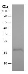    WFDC3 / Recombinant Human WFDC3