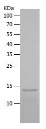    PVALB / Recombinant Human PVALB