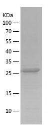    BRIP1 / Recombinant Human BRIP1