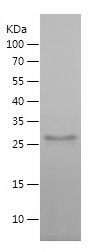    VPS52 / Recombinant Human VPS52