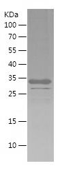    APC / Recombinant Human APC