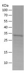    KHSRP / Recombinant Human KHSRP