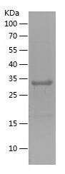    ZKSCAN3 / Recombinant Human ZKSCAN3