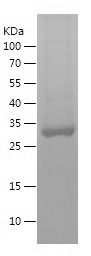    SULT2A1 / Recombinant Human SULT2A1