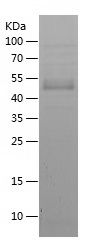    ZEB1 / Recombinant Human ZEB1