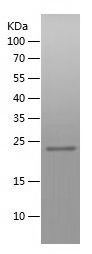    ZC3HAV1 / Recombinant Human ZC3HAV1