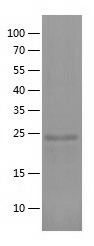    ZNF746 / Recombinant Human ZNF746