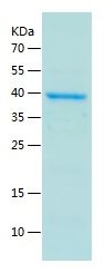    BCL6 / Recombinant Human BCL6