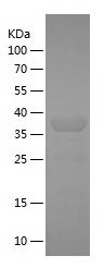    ARMC10 / Recombinant Human ARMC10