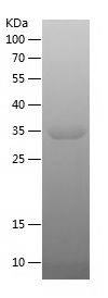    DLEU1 / Recombinant Human DLEU1