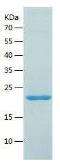    CRYAB / Recombinant Human CRYAB