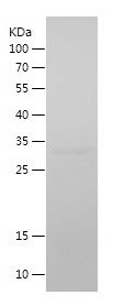    CDH13 / Recombinant Human CDH13