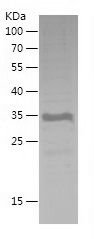    BMI1 / Recombinant Human BMI1