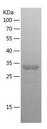    COL6A1 / Recombinant Human COL6A1