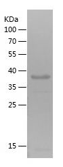    CD56 / Recombinant Human CD56