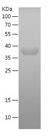    CALD1 / Recombinant Human CALD1