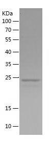    PAX8 / Recombinant Human PAX8