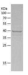    TMEM168 / Recombinant Human TMEM168