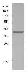    SH3PXD2A / Recombinant Human SH3PXD2A