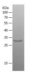    AXIN2 / Recombinant Human AXIN2