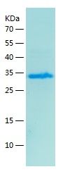    SLC16A3 / Recombinant Human SLC16A3