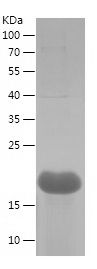    THRSP / Recombinant Human THRSP