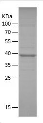    ARMCX1 / Recombinant Human ARMCX1