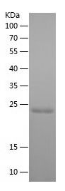    GLO1 / Recombinant Human GLO1