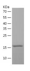    ETS1 / Recombinant Human ETS1