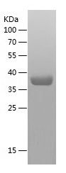    AFF4 / Recombinant Human AFF4