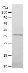    SHMT2 / Recombinant Human SHMT2