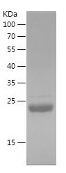    TK1 / Recombinant Human TK1