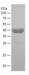    DES / Recombinant Human DES