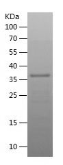    TMX3 / Recombinant Human TMX3