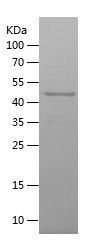    SLC25A13 / Recombinant Human SLC25A13