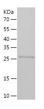    TH / Recombinant Human TH