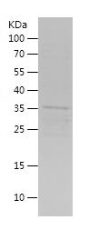    SIX2 / Recombinant Human SIX2