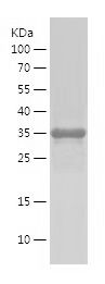    UPA / Recombinant Human UPA