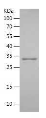    UPK2 / Recombinant Human UPK2