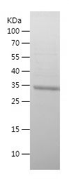    TMPRSS4 / Recombinant Human TMPRSS4