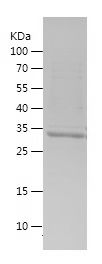    UBA52 / Recombinant Human UBA52