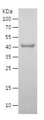    SIRT2 / Recombinant Human SIRT2